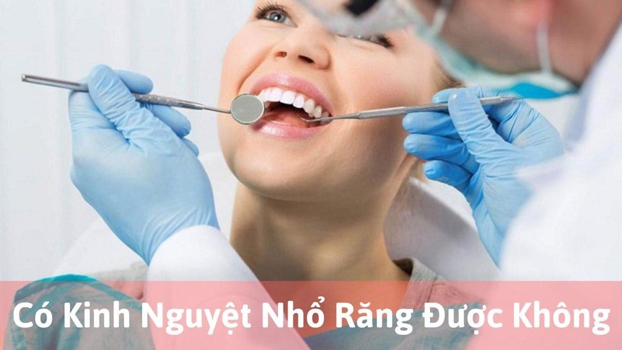 có kinh nguyệt nhổ răng