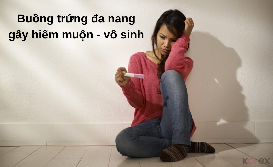 Bệnh buồng trứng đa nang dẫn đến vô sinh, hiếm muộn