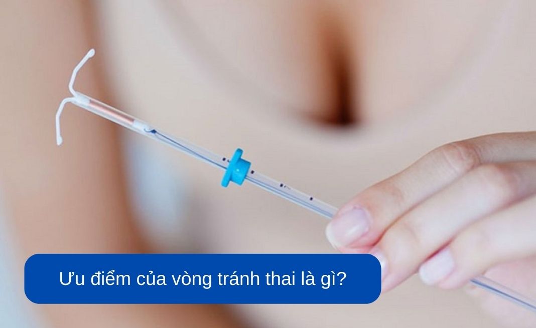 Một số lợi ích khi đặt vòng tránh thai