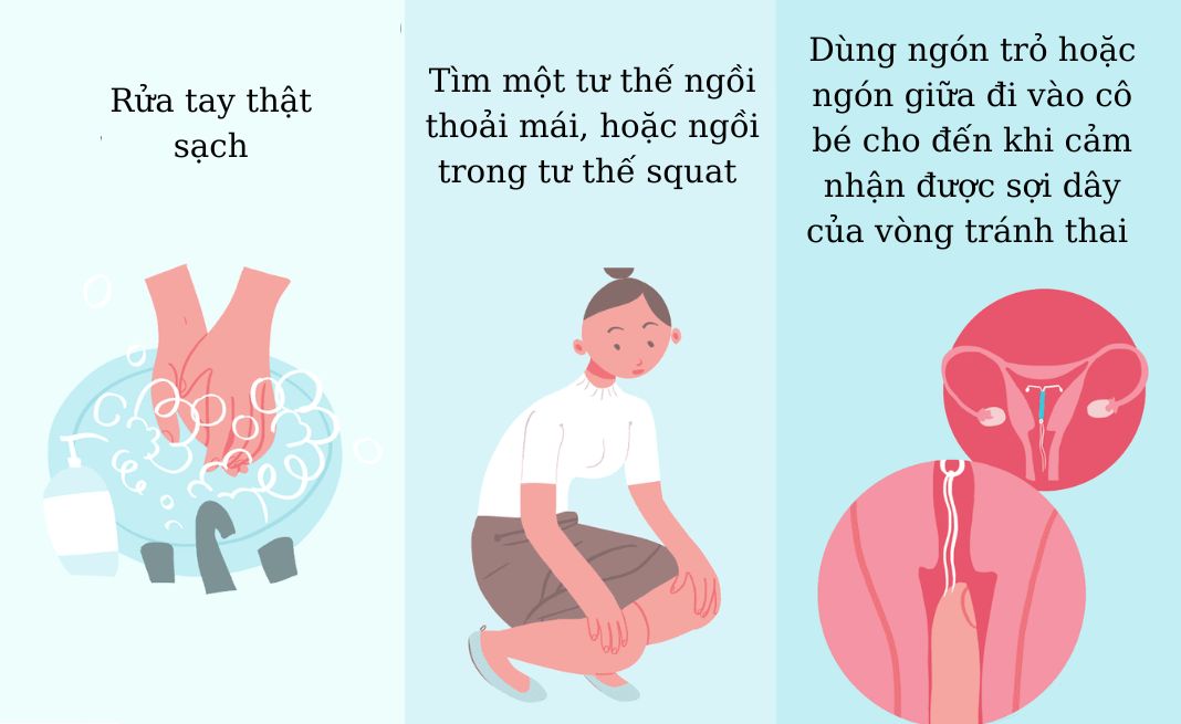 cách xác định vị trí vòng tránh thai