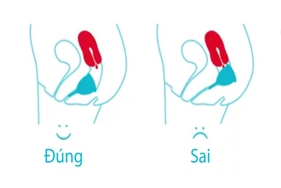 4. Lợi ích khi sử dụng cốc nguyệt san