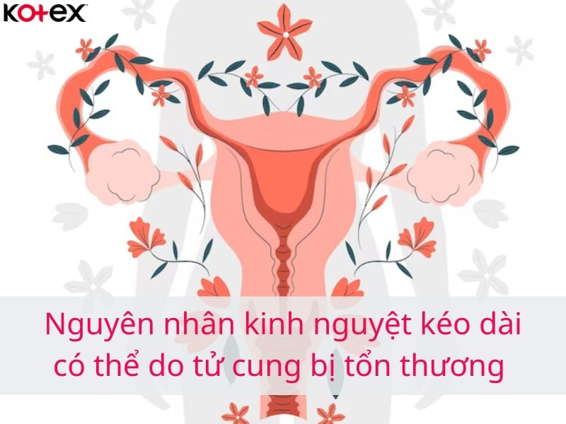 Nguyên nhân kinh nguyệt kéo dài có thể do tử cung bị tổn thương