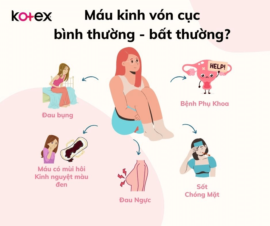 Một số biểu hiện bình thường và bất thường của tình trạng máu kinh vón cục 