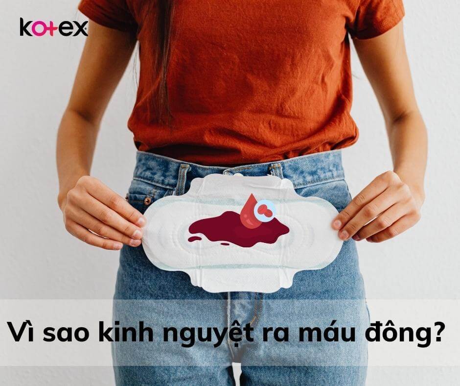 Kinh nguyệt ra máu đông có phải dấu hiệu của bệnh lý