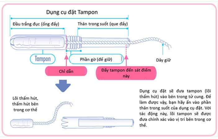 Tampon là gì?