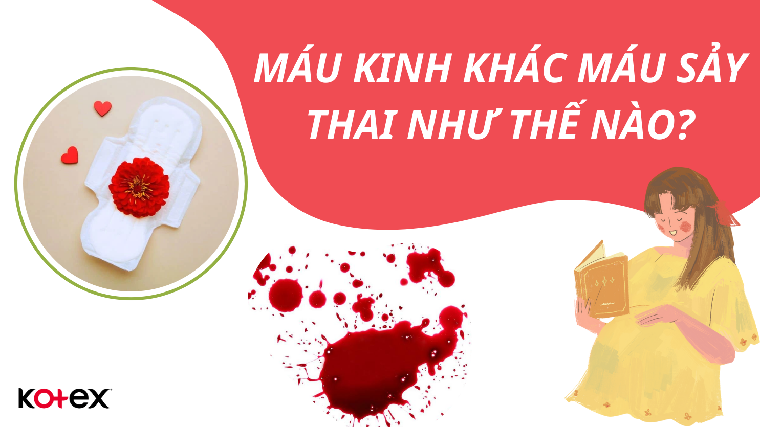 4. Thời Gian Phục Hồi và Chu Kỳ Kinh Nguyệt Trở Lại Sau Sảy Thai